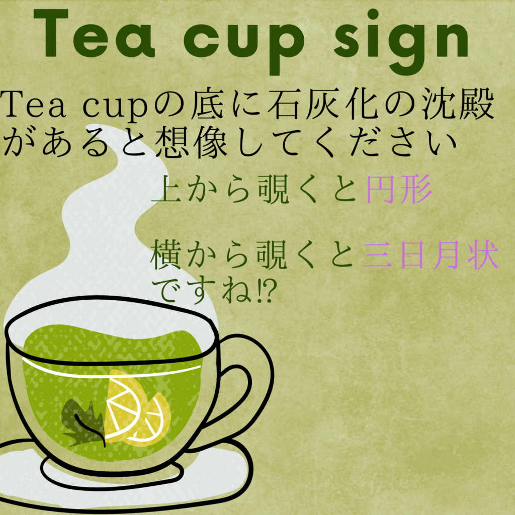 乳房撮影におけるTea Cup Signのイメージ図